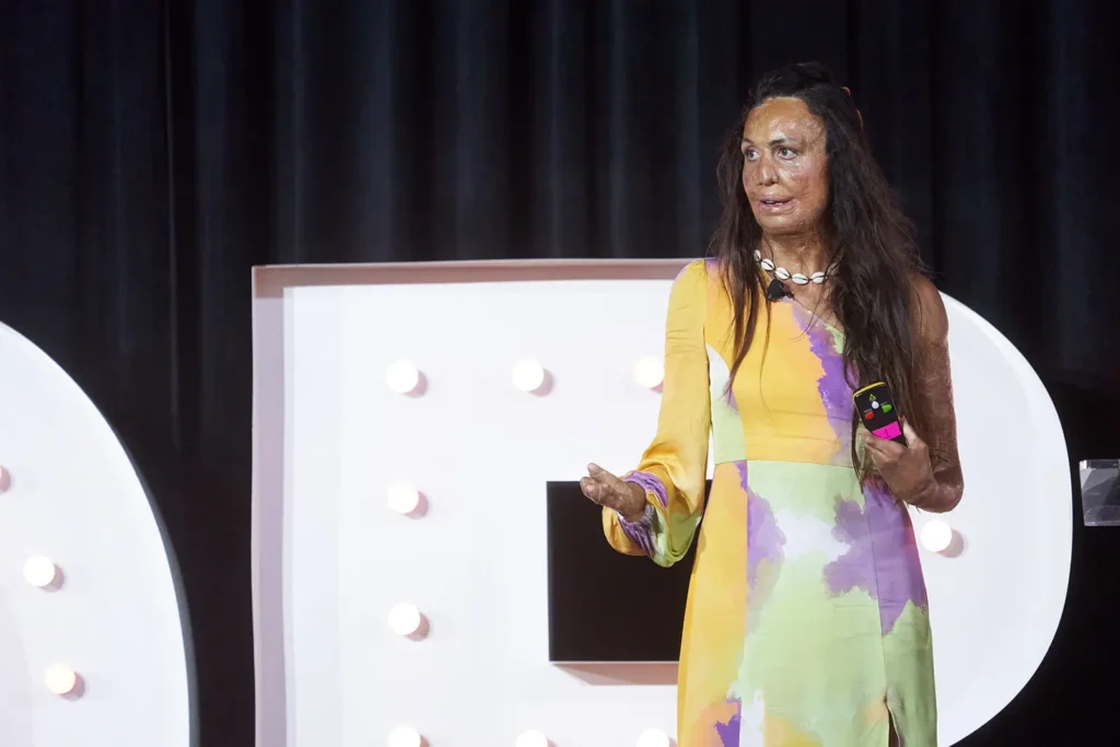 Turia Pitt speaking at Busy Bees Conference and Excellence Awards